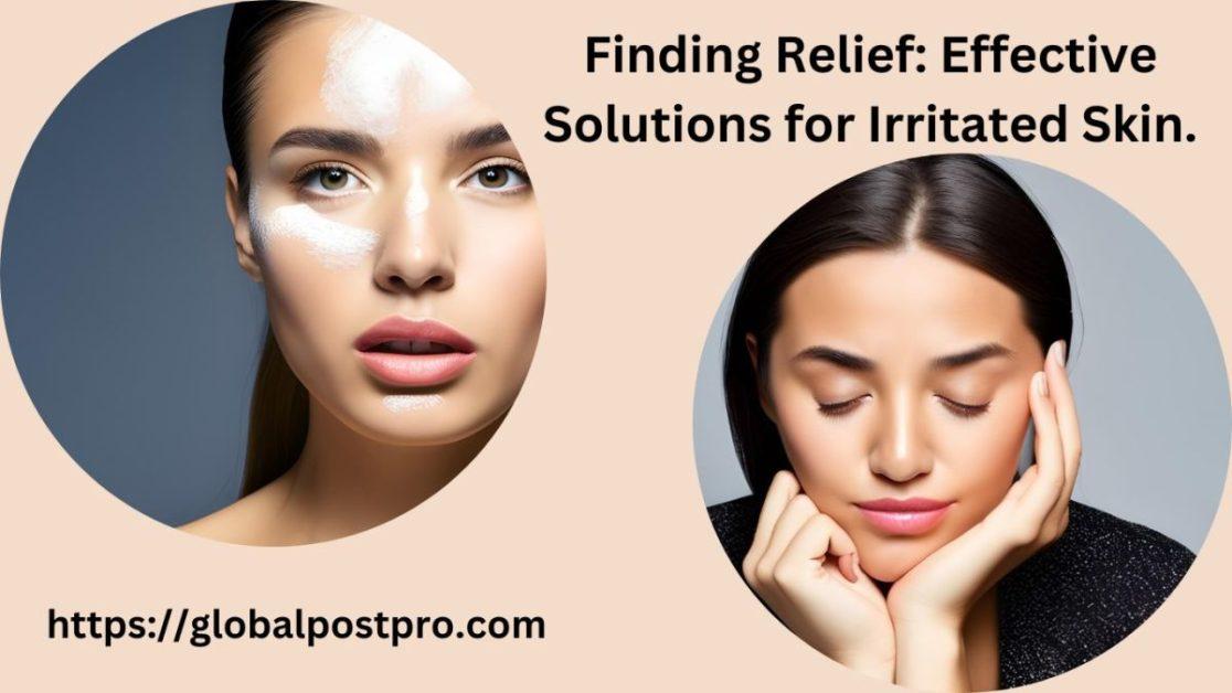 Finding Relief: 9 Effective Solutions for Irritated Skin.
